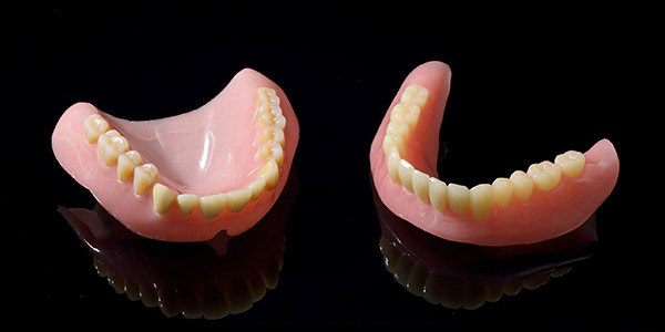 部分入れ歯の種類